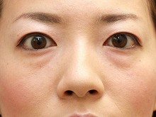 pO