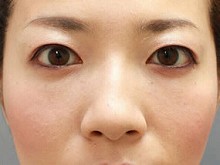 Ǘ摜
