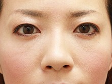 Ǘ摜