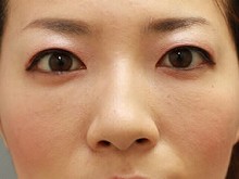 Ǘ摜