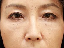 Ǘ摜
