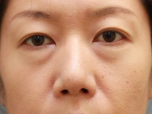 pO