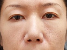 Ǘ摜