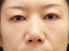 Ǘ摜