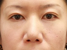 Ǘ摜