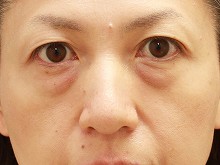 pO