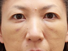 Ǘ摜