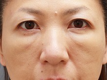 Ǘ摜