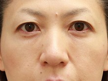 Ǘ摜