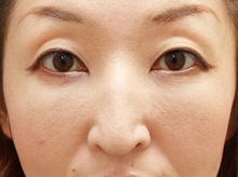 Ǘ摜